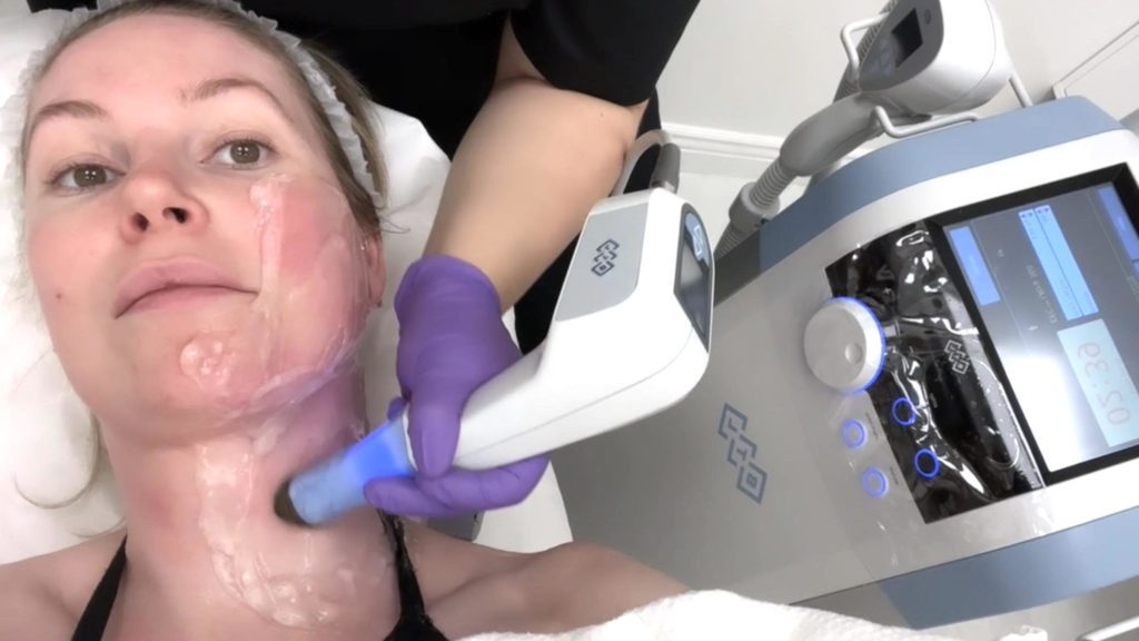 Exilis-Ultra-360-ansikte.jpeg