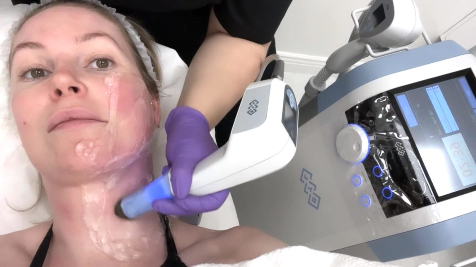Exilis-Ultra-360-ansikte.jpeg