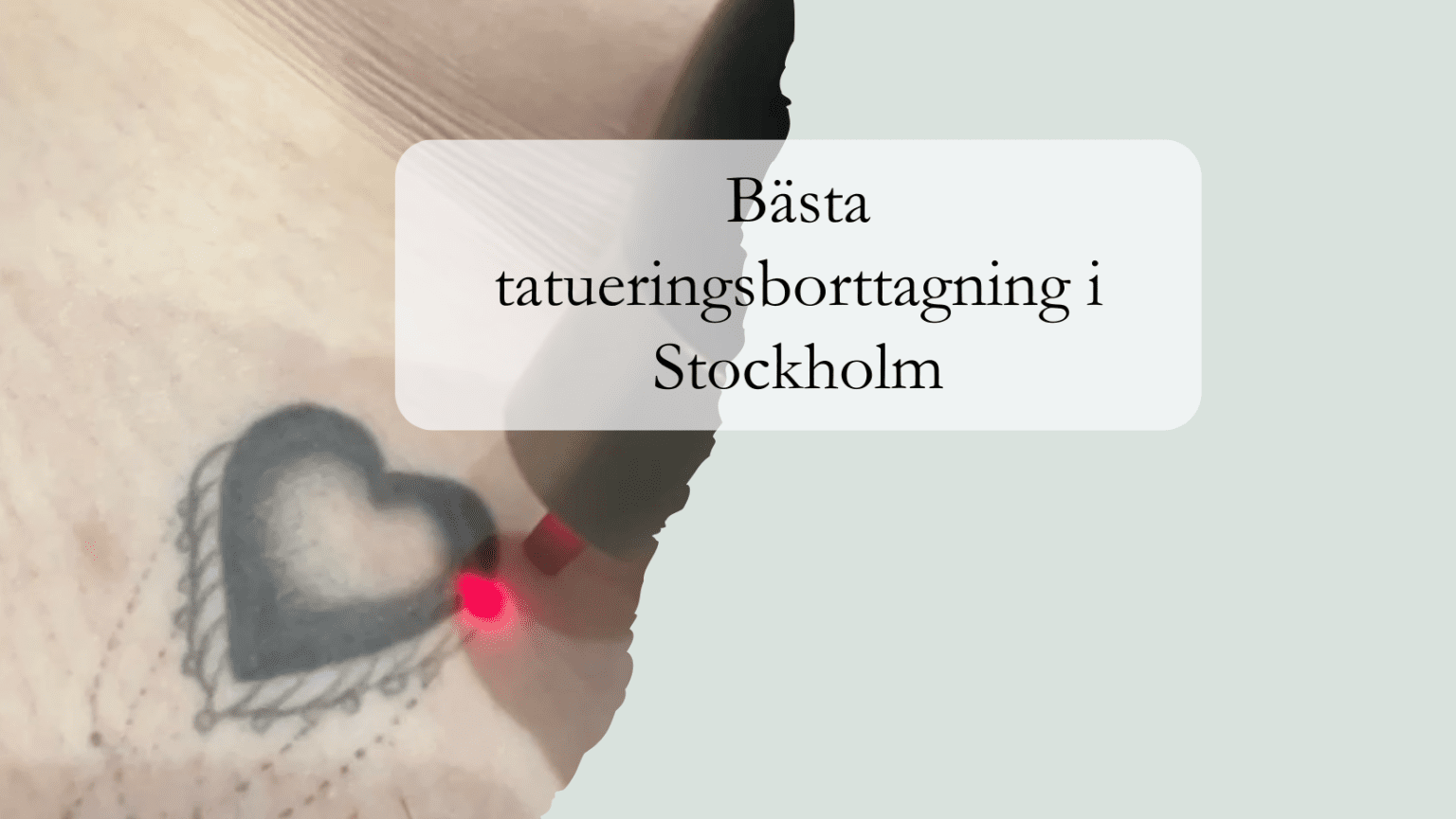bästa tatueringsborttagning i Stockholm