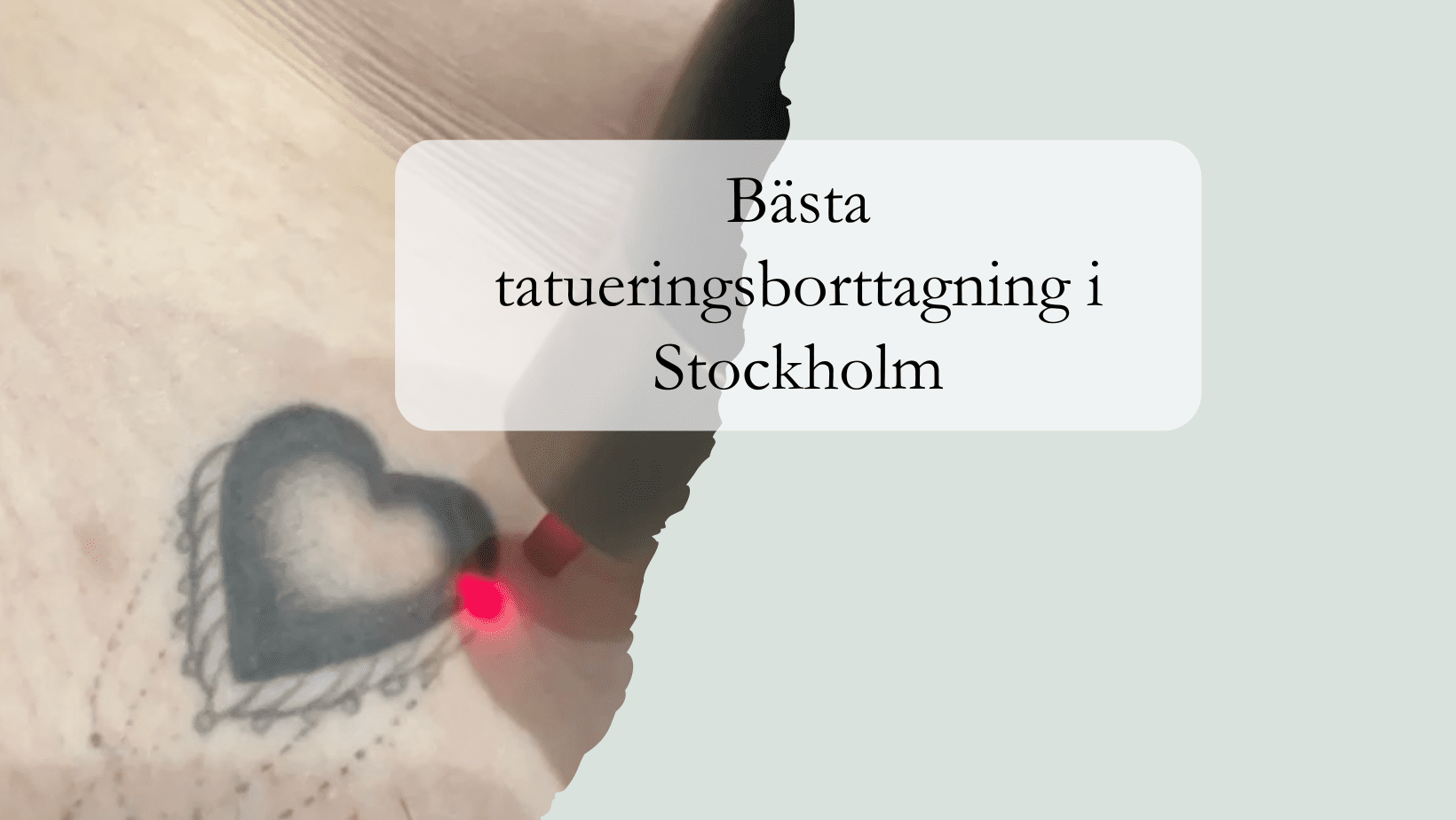 bästa tatueringsborttagning i Stockholm