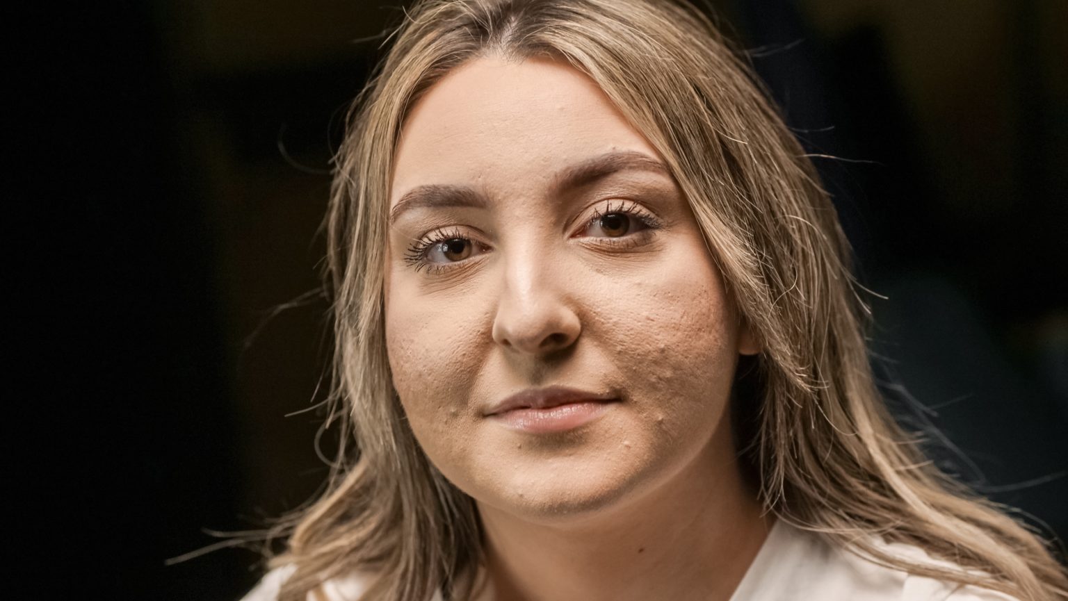 behandla aktiv acne